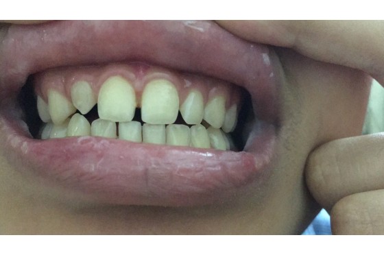 Thẩm mỹ và sức khỏe răng miệng